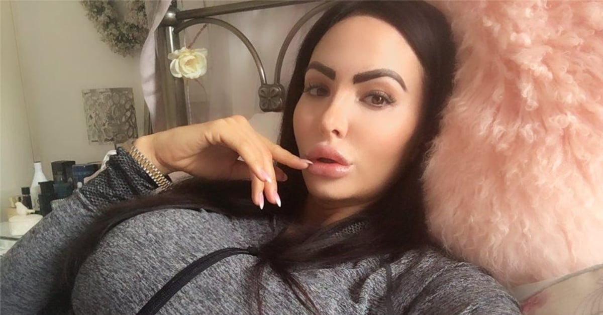 Жена даде десетки хиляди за щръкнало дупе, а сега изглежда така, сякаш носи памперс СНИМКИ