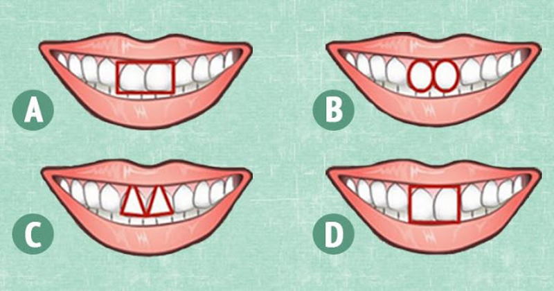 Тест: Зъбите ви издават огромна тайна за вас