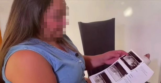 Майка откри нещо притеснително по тялото на 5-г. си дъщеря и животът й се превърна в ад СНИМКИ