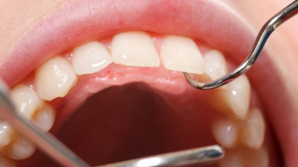 Зъбите ви са развалени? Погрижете се веднага за тях, за да не си докарате по-големи проблеми!