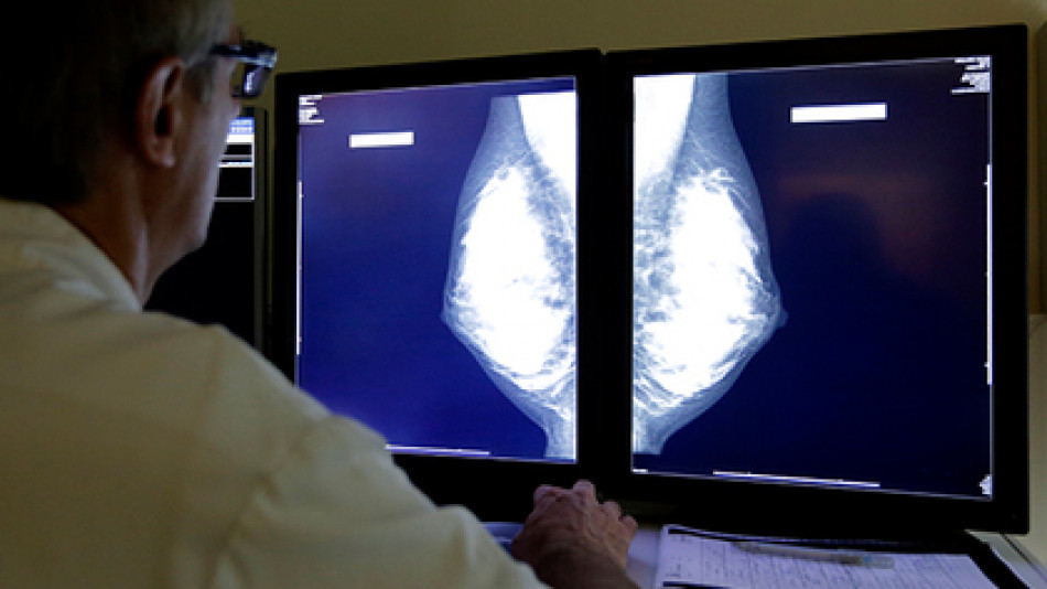 Биолози откриха ефективно средство срещу рака на гърдата