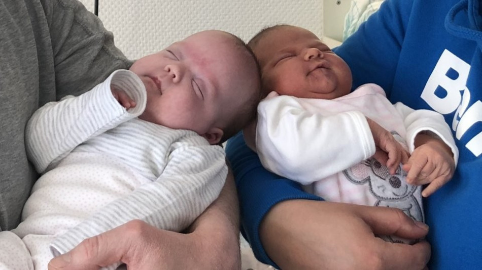 Цяла Германия говори за чудото с тези близначки, родени... (СНИМКИ)
