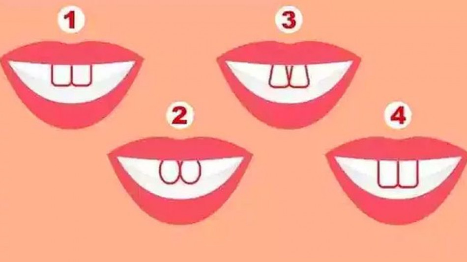 Тест: Формата на предните ви зъби разкрива нещо неочаквано за вас