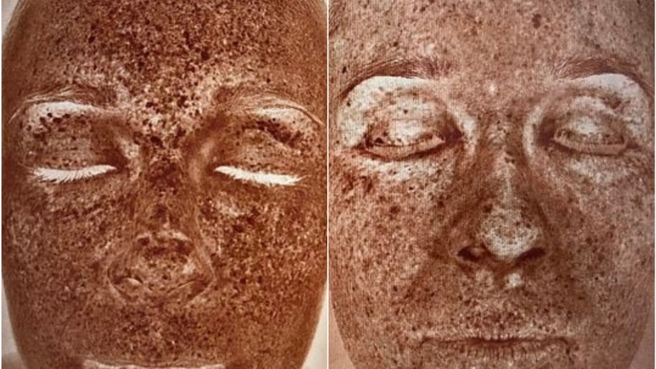 Момиче с ужас откри колко се е състарила кожата й от стоенето пред компютъра СНИМКИ