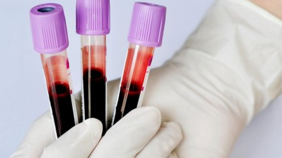 Психолог разкри как кръвната група определя съдбата ви