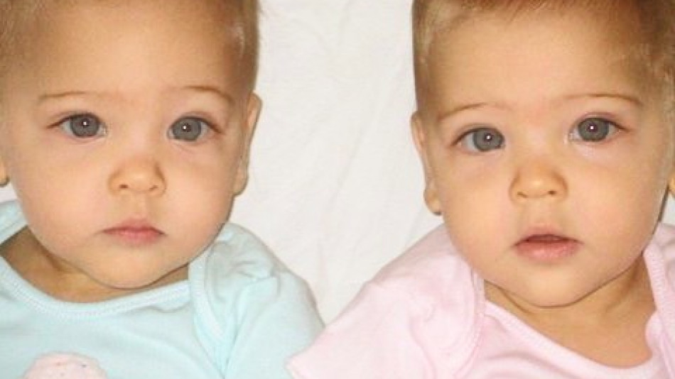 Ето как изглеждат днес най-красивите близначки в света СНИМКИ