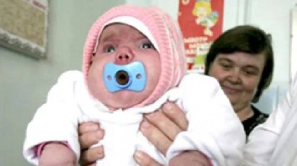 Това 8-килограмово бебе шокира всички, а 13 години по-късно... СНИМКИ