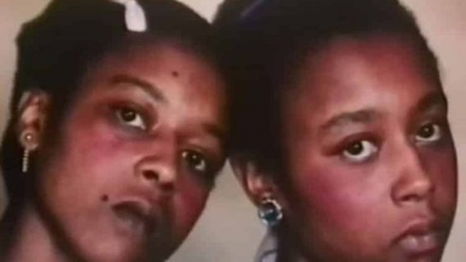 Историята на близначките Гибънс, които говореха на свой език и сключиха пакт за смърт, ужаси света 