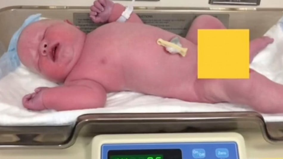 Майка роди бебе гигант и показа как изглежда 5 години по-късно ВИДЕО