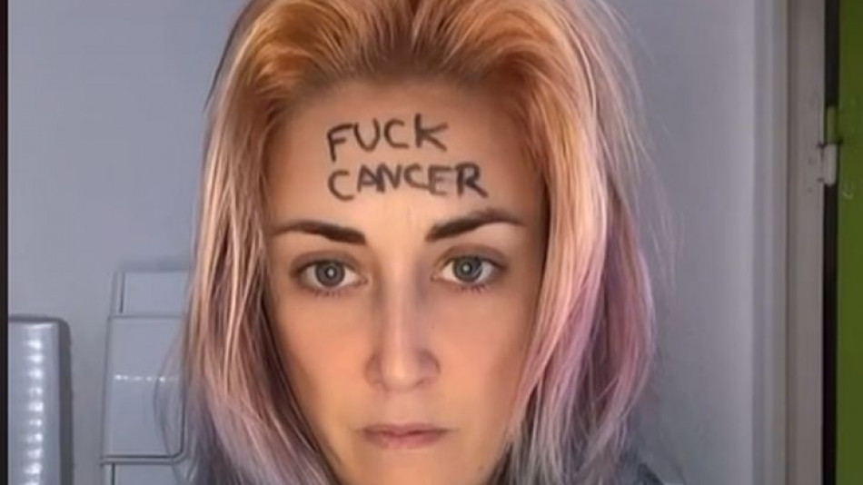 Брутално: Болна от рак красавица показа ада, през който минава ВИДЕО