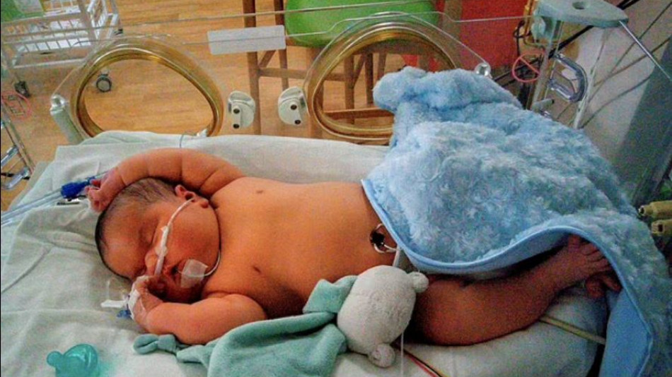 Когато се роди, това бебе тежеше близо 7 кг, а 5 месеца по-късно... СНИМКИ